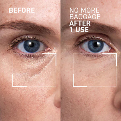 No More Baggage Eye Bag Cream-Depuff, Tighten & Brighten Tired Under-Eyes in Just 5 Minutes
