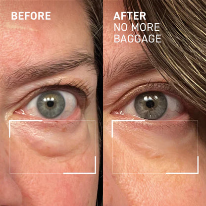 No More Baggage Eye Bag Cream-Depuff, Tighten & Brighten Tired Under-Eyes in Just 5 Minutes