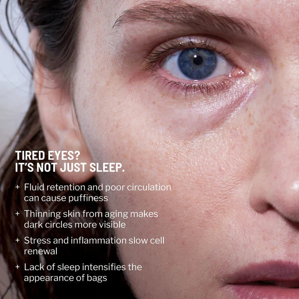 No More Baggage Eye Bag Cream-Depuff, Tighten & Brighten Tired Under-Eyes in Just 5 Minutes